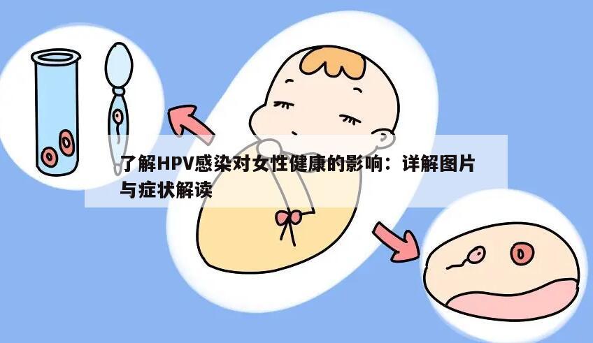 了解HPV感染对女性健康的影响：详解图片与症状解读
