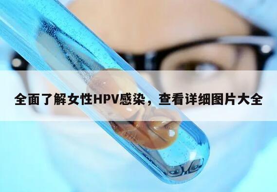 全面了解女性HPV感染，查看详细图片大全