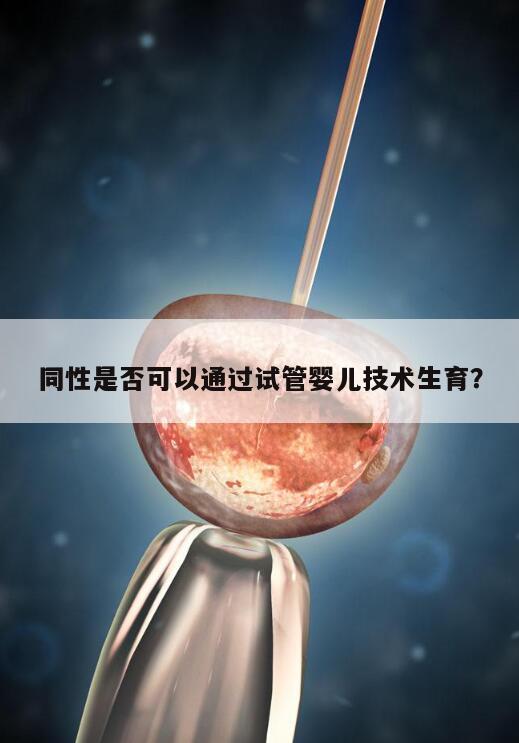 同性是否可以通过试管婴儿技术生育？