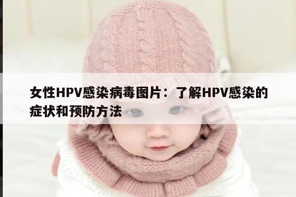 女性HPV感染病毒图片：了解HPV感染的症状和预防方法