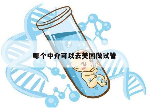 哪个中介可以去美国做试管