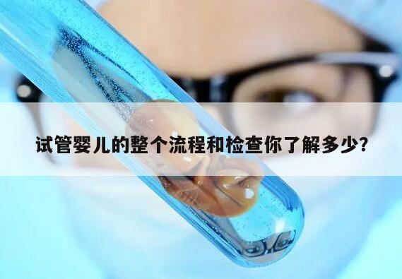 试管婴儿的整个流程和检查你了解多少？