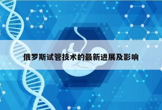 俄罗斯试管技术的最新进展及影响