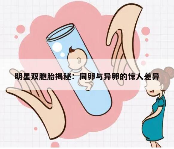 明星双胞胎揭秘：同卵与异卵的惊人差异
